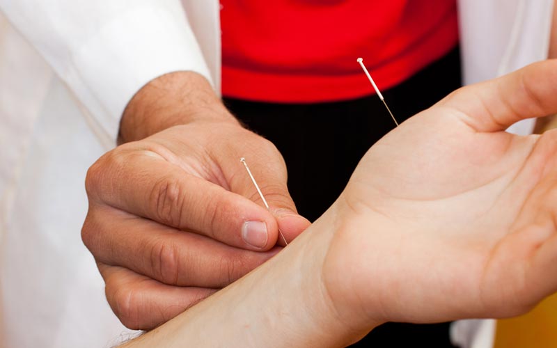 Read more about the article Penanganan stroke dengan terapi akupuntur