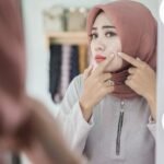 Terapi akupuntur dapat mengatasi jerawat2