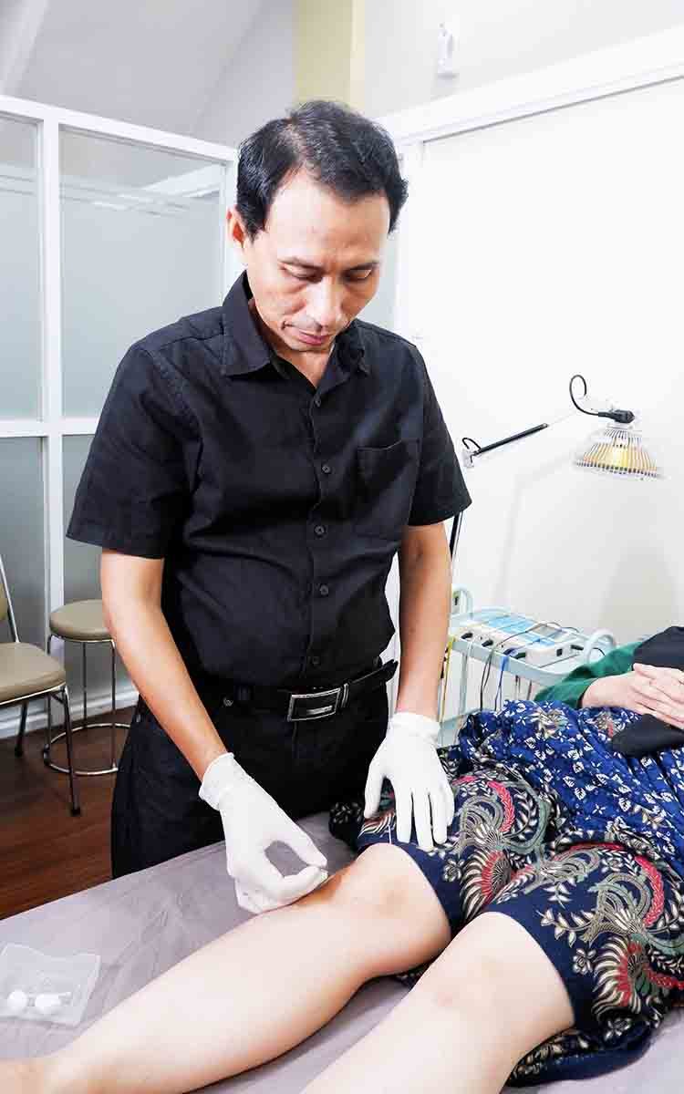 akupuntur lutut22