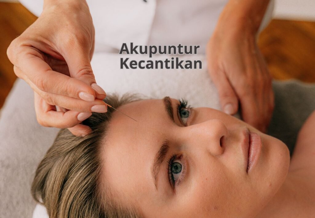 Akupuntur kecantikan aufar
