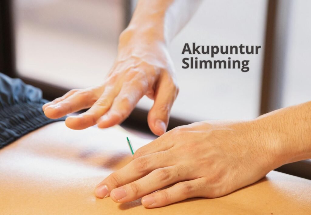 Akupuntur slimming aufar