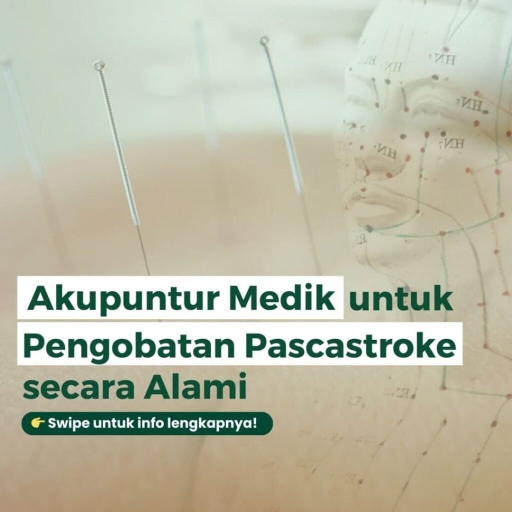 Terapi akupuntur stroke aufar